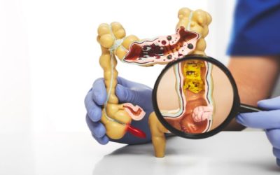 ¿QUÉ ES LA COLOPROCTOLOGÍA?