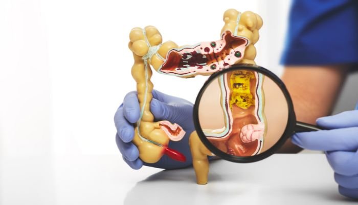 ¿QUÉ ES LA COLOPROCTOLOGÍA?