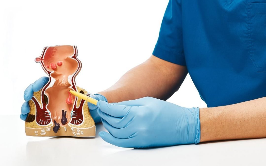 DESCUBRIENDO LA COLOPROCTOLOGÍA: ENFERMEDADES Y DIAGNÓSTICOS.