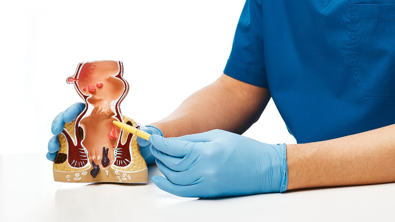 Dr – Juan Antonio Villanueva Herrero – Discovering the Coloproctology Diseases and Diagnostics Dr - Juan Antonio Villanueva Herrero - Descubriendo la Coloproctología Enfermedades y Diagnósticos