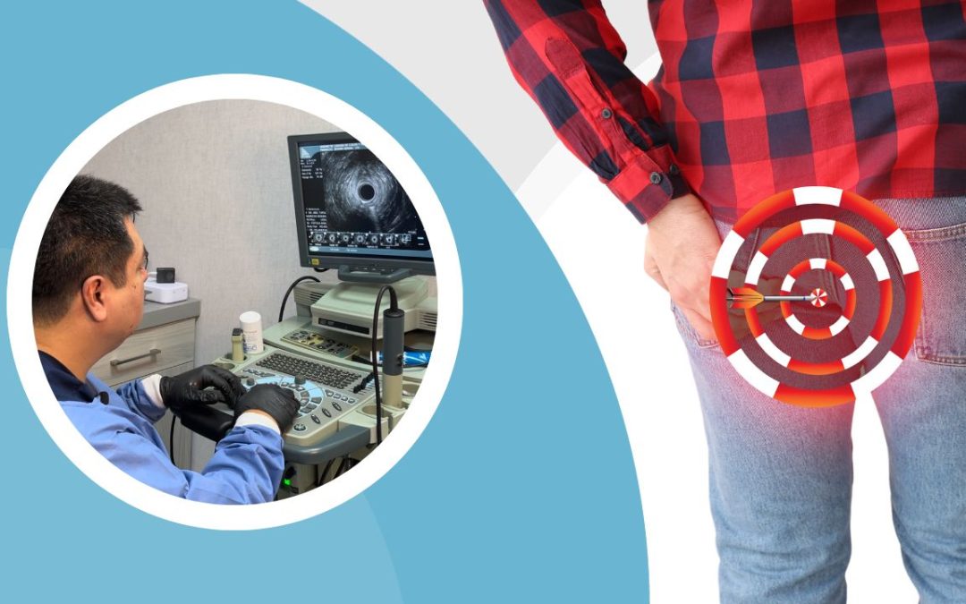 ULTRASONIDO ENDOANAL: LA HERRAMIENTA CRUCIAL DE LA COLOPROCTOLOGÍA