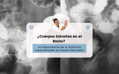CUERPOS EXTRAÑOS EN EL RECTO: UN TEMA DELICADO PERO CRUCIAL.